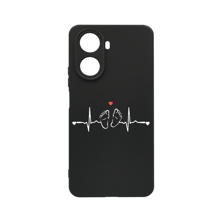 BestCase Slim Szilikon 0.8MM telefontok, Huawei Nova 10 SE, My Little Love, c-B 966