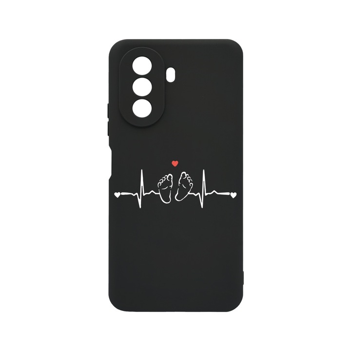 Силиконов калъф BestCase за Huawei Nova Y70, My Little Love, 0.8MM Slim, Black Silicon Series, c-B 966