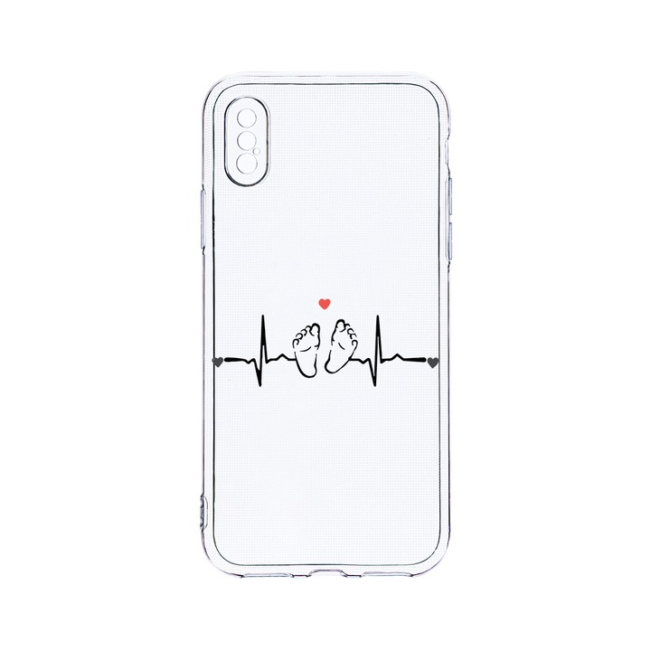 Husa BestCase® Clear Silicon 2MM, Compatibila Cu Apple iPhone XS / iPhone X, My Little Love, Antisoc, Protectie Camera, Margini ridicate pentru protectia ecranului, T 966