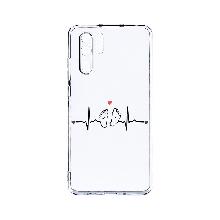 Силиконов калъф BestCase за Huawei P30 Pro, My Little Love, Camera Protection, Clear Silicon 2.0MM, T 966