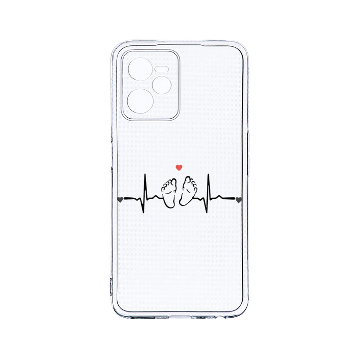 Силиконов калъф BestCase за Realme Narzo 50A Prime / C35, My Little Love, Camera Protection, Clear Silicon 2MM, T 966