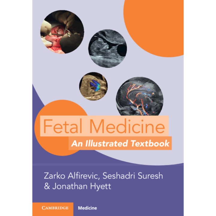 Fetal Medicine de Zarko Alfirevic