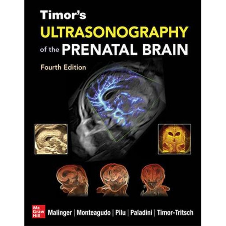 Timor's Ultrasonography of the Prenatal Brain de Ilan Timor-Tritsch
