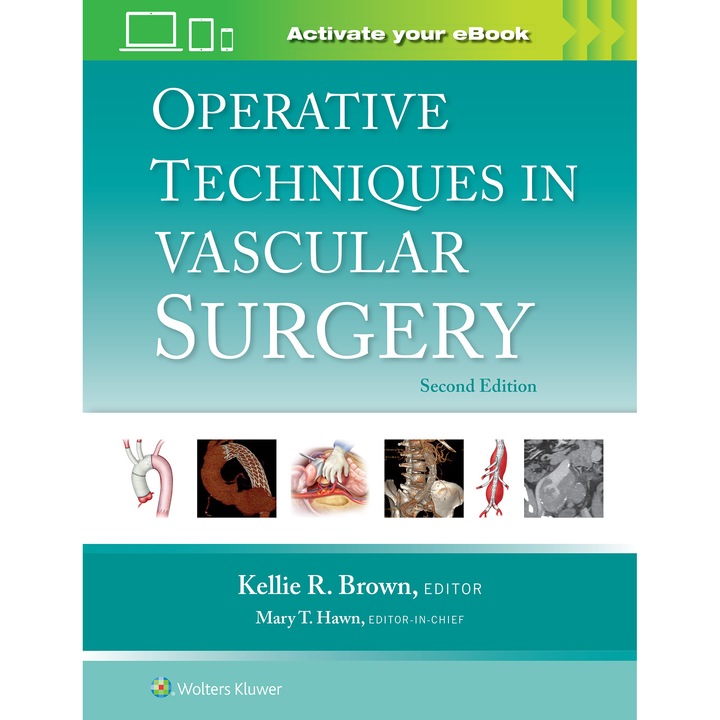 Operative Techniques in Vascular Surgery de Kellie R. Brown M.D