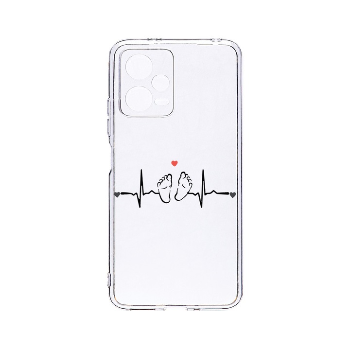 BestCase 2MM Clear Szilikon telefontok, Xiaomi Redmi Note 12 5G, My Little Love, Kamera védelem, strapabíró, T 966