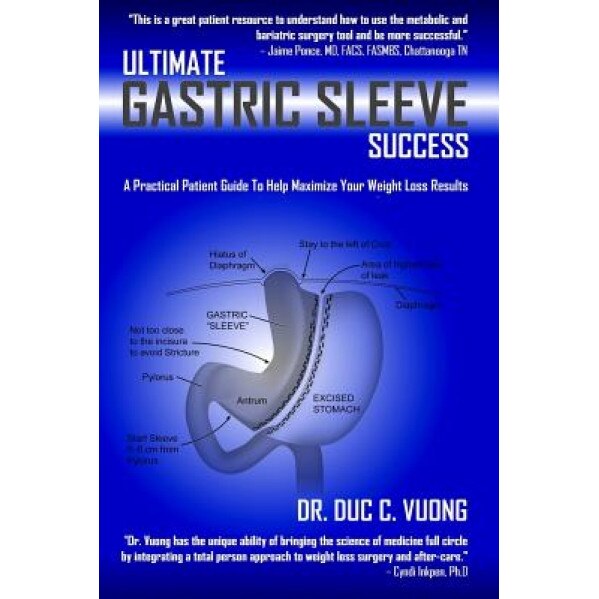 Ultimate Gastric Sleeve Success: A Practical Patient Guide to Help Maximize Your Weight Loss Results, Dr Duc C. Vuong (Author)