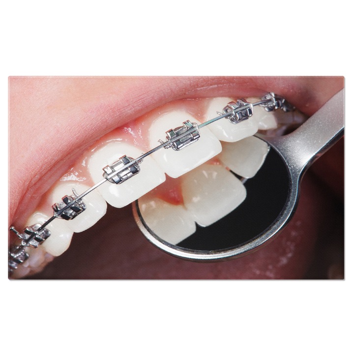 Tablou Canvas - Medicina Dentara: Tratament Oral, Dentist, Instrumente, Clinica Dentala 100x70CM