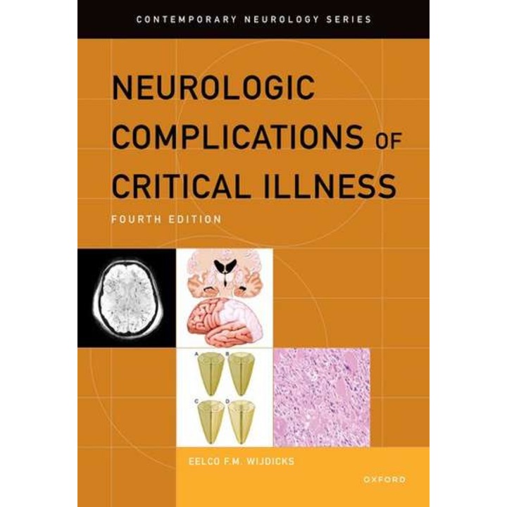 Neurologic Complications of Critical Illness de Eelco F.M. Wijdicks