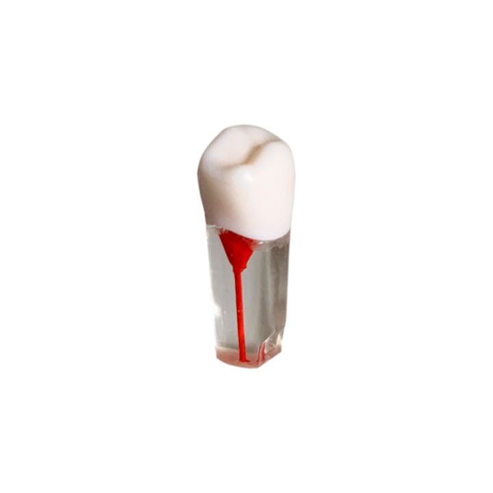 Endobloc 35 - kompatibilis a 8011-es csavarral ellátott, kivehető fogazatú modellel