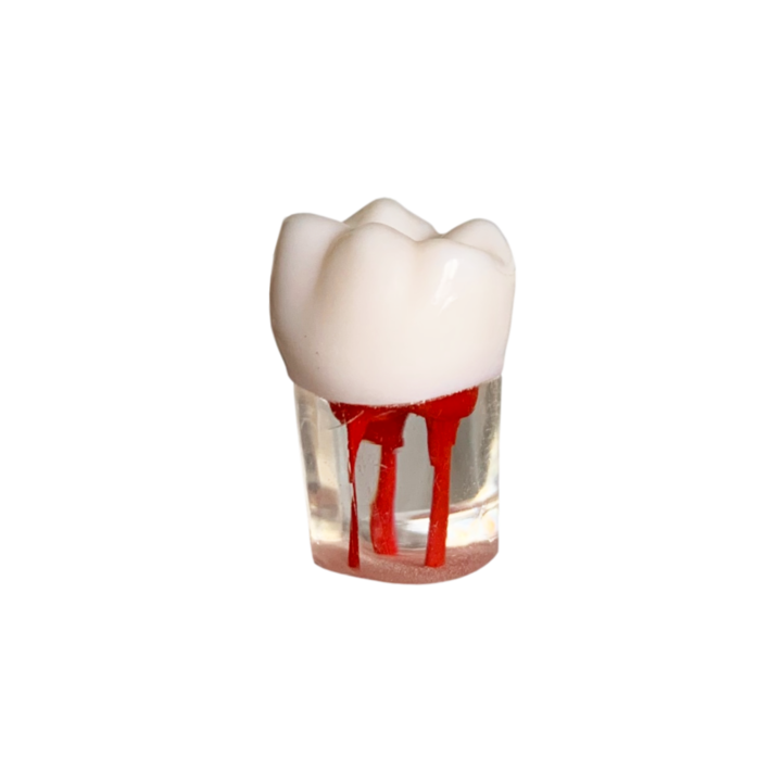Endobloc 36 - kompatibilis a 8011-es csavarral ellátott, kivehető fogazatú modellel