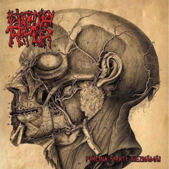 Histos: Pricina Smrti Neznama [CD]