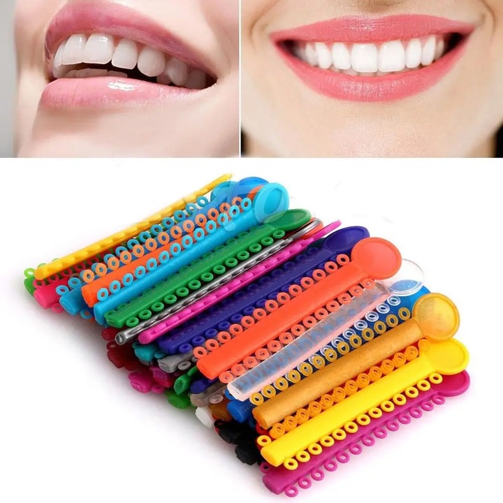 Set de 40 elastice pentru aparatul dentar, NUODWELL, Usor de utilizat si de transportat, Pentru tratamentul de ortodontie dentara, Plastic, Multicolor