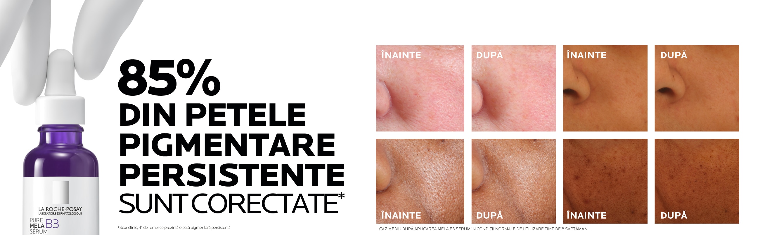 ser-concentrat-intensiv-pentru-corectarea-petelor-pigmentare-la-roche
