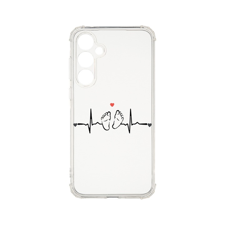 Husa BestCase® Anti Shock 1.5MM, Compatibila Cu Samsung Galaxy A55 5G, My Little Love, Rezistenta La Socuri, Protectie Camera, Margini ridicate pentru protectia ecranului, AS 966