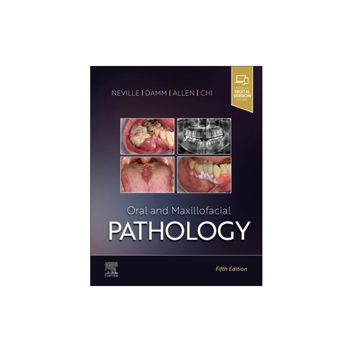 Oral and Maxillofacial Pathology, Brad W. Neville
