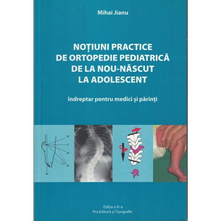 Notiuni practice de ortopedie pediatrica de la Nou-Nascut la Adolescent - Mihai Jianu
