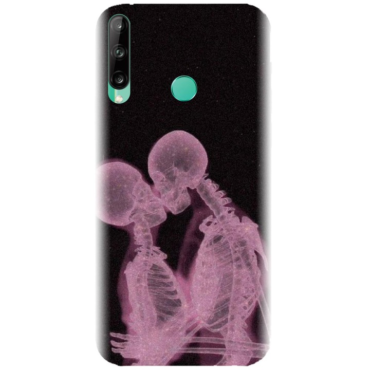 Husa din silicon compatibila cu Huawei P40 Lite E - model X Ray