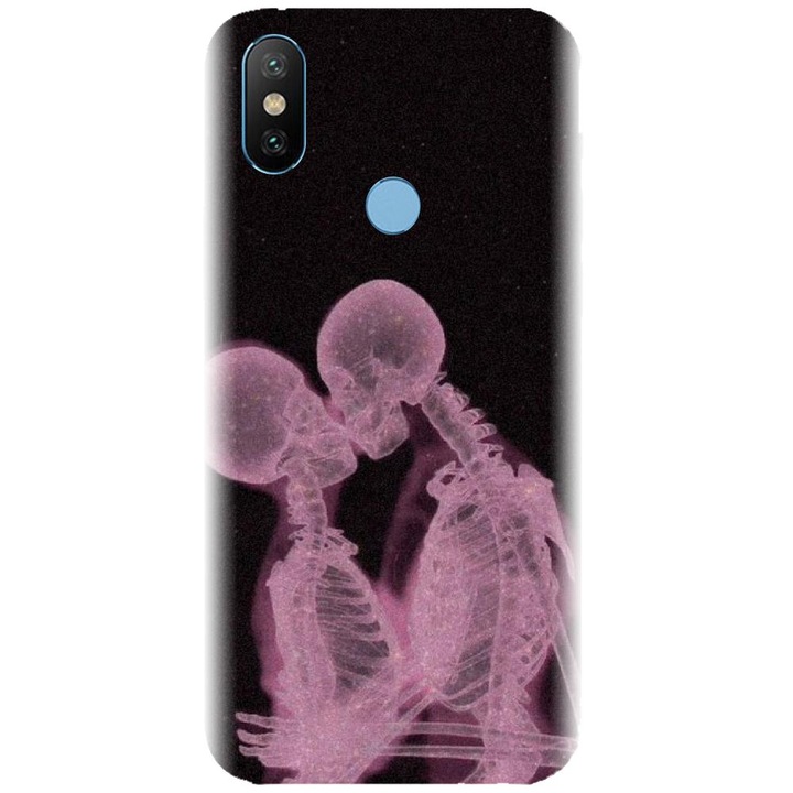 Силиконов калъф, съвместим с Xiaomi Mi A2 - модел X Ray