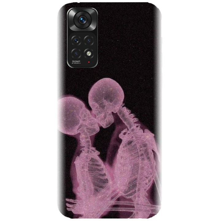 Силиконов капак, съвместим с Xiaomi Redmi Note 11s 4g - модел X Ray
