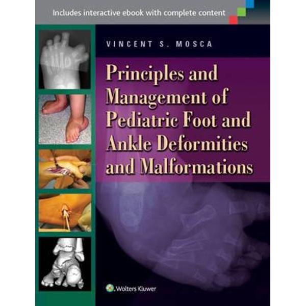 Principles and Management of Pediatric Foot and Ankle Deform