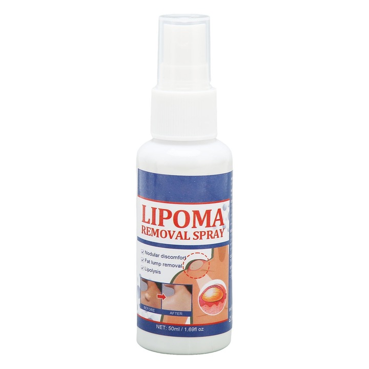 Lipoma eltávolító spray, BGHYHYHI, 50 ml, többszínű