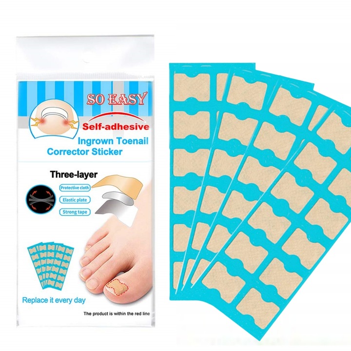 Set de 72 plasturi de corectare a unghiilor incarnate, Bumbac elastic, enkourakoko®, Bej