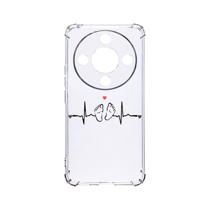 BestCase® Устойчив на удари калъф 1.5MM, съвместим с Honor X9b / Magic6 Lite / X50 5G, My Little Love, устойчив на удари, защита на камерата, AS 966