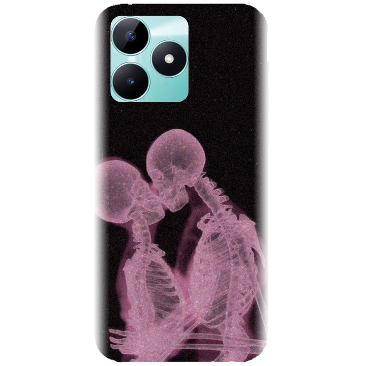 Husa din silicon compatibila cu Realme C51 - model X Ray