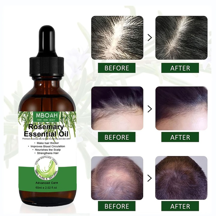 Bio rozmaring illóolaj hajnövekedéshez, 60 ml, fejbőr masszázshoz, bőrápoláshoz, aromaterápiához