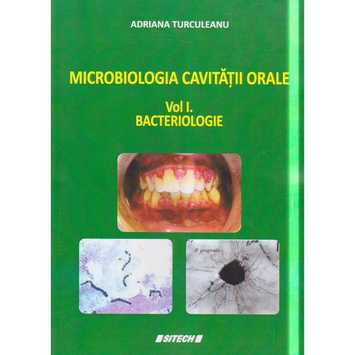 Microbiologia cavitatii orale - Volumul I (Bacteriologie), Adriana Turculeanu