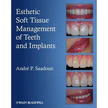 Esthetic Soft Tissue Management of Teeth and Implants Esthetic Soft Tissue Management of Teeth and Implants