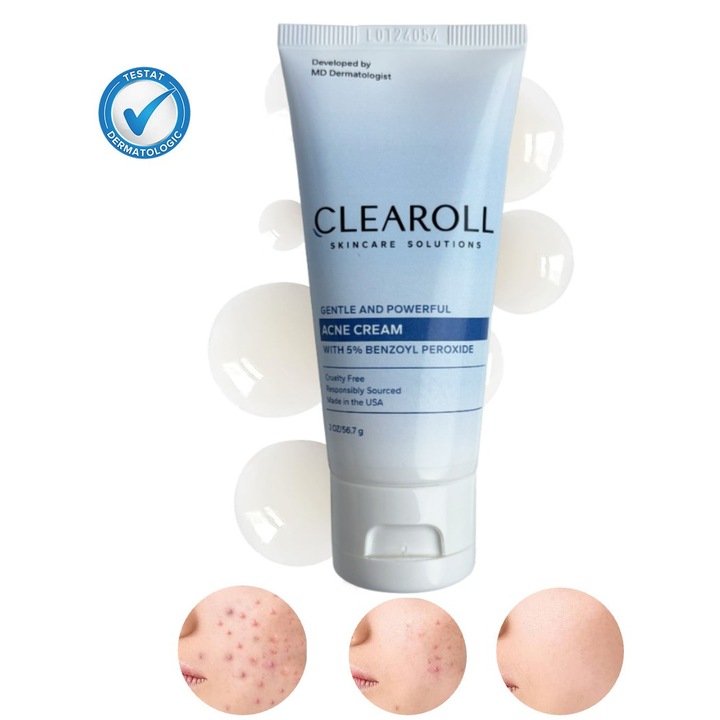 Crema anti- acnee cu peroxid benzoil 5%, Clearoll® Tratarea acneei si cosurilor inflamate, previne aparitia eruptiilor, reduce roseata si inflamatia, mentine tenul curat si protejat, produs dermatologic, 56.7 g