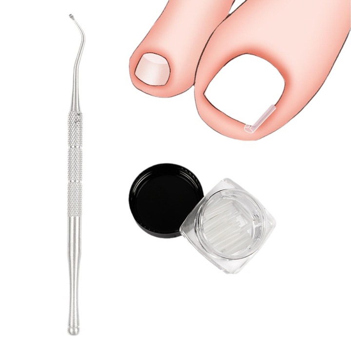 KUNSANM Комплект за корекция на врастнал нокът, 20 бр., прозрачен, тип C, гъвкав, дишащ