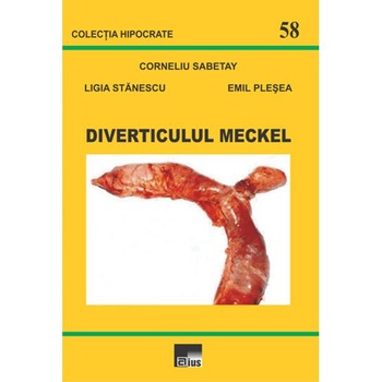 Diverticulul Meckel - Corneliu Sabetay, Ligia Stanescu, Emil Plesea Diverticulul Meckel - Corneliu Sabetay, Ligia Stanescu, Emil Plesea