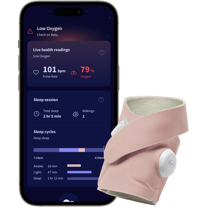 Dispozitiv inteligent pentru monitorizarea bebelusului Owlet Dream Sock Pink, certificat medical, 0-18 luni, 2.5-13.6 kg, roz