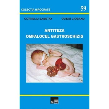 Antiteza omfalocel gastroschizis - Corneliu Sabetay, Ovidiu Ciobanu Antiteza omfalocel gastroschizis - Corneliu Sabetay, Ovidiu Ciobanu