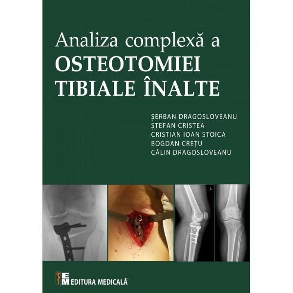 Analiza complexa a Osteotomiei Tibiale Inalte - Serban Dragosloveanu