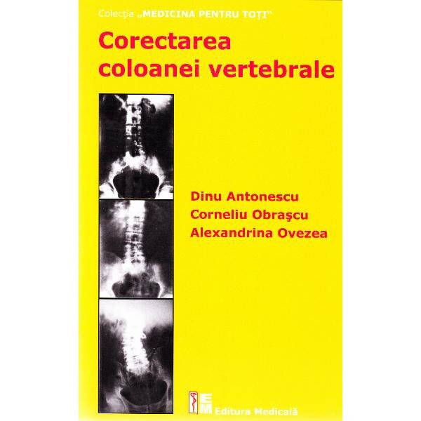 Corectarea coloanei vertebrale - Dinu Antonescu