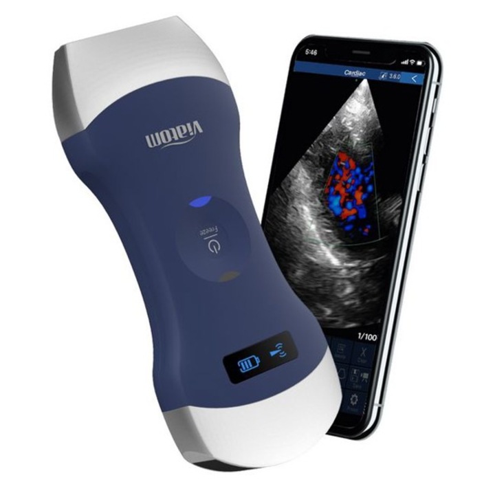 Ecograf portabil wireless cu cap dublu (liniar/convex)