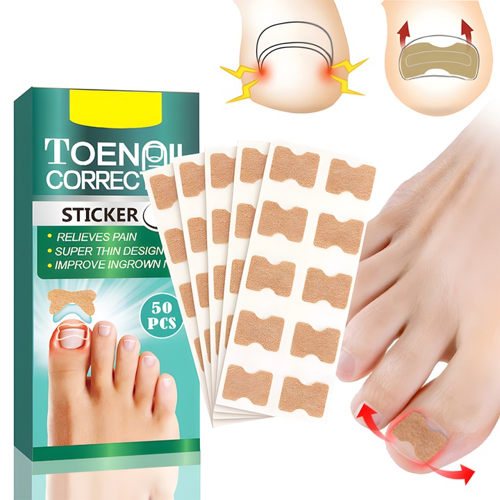 Комплект от 50 лепенки за корекция на враснали нокти, Chucai, телесен цвят, 1.3x1.8 см