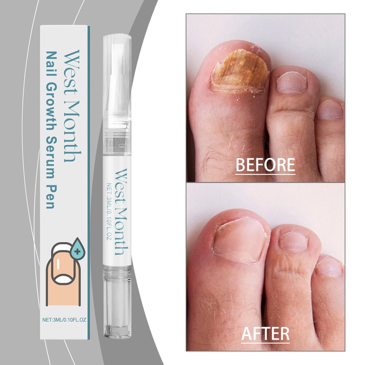 Комплект от 3 писалки за грижа за нокти, West&Month хидратиращи и подхранващи, многоцветни