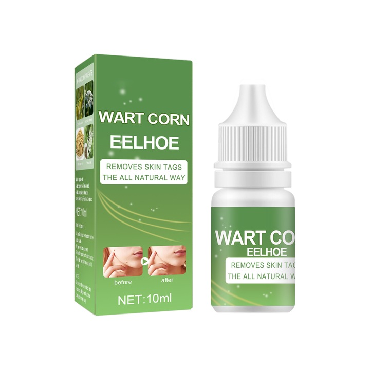 Szemölcs eltávolító testápoló, EELHOE, 10ml