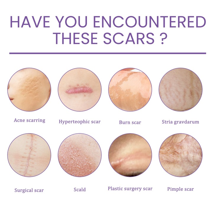 Arckrém, EELHOE, hegkezelés, hidratálás, 50ml