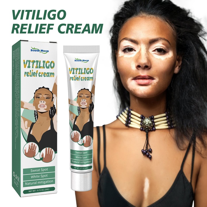 South Moon Vitiligo krém, fehér foltok és virágfoltok ellen, helyi bőrápoló kenőcs