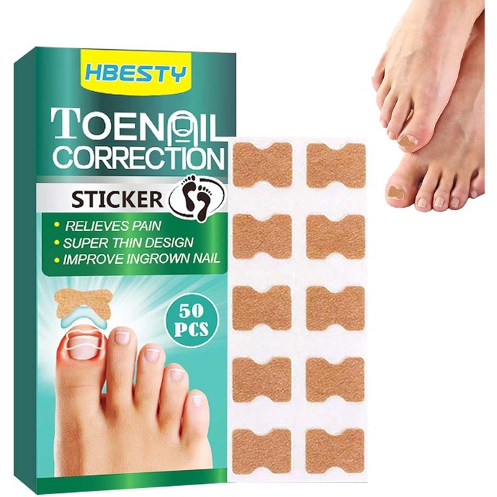 Set de 50 plasturi corectori pentru unghii incarnate, verde, 13x1.25mm