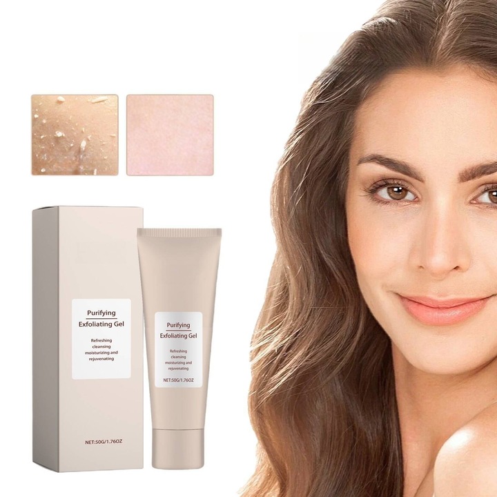 Gel Exfoliant pentru Ten, Curatare Blanda, Control Puncte Negre si Acnee, 50g