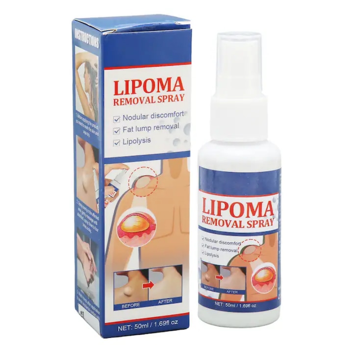 Spray pentru indepartarea lipomelor, spray pentru dizolvarea nodulilor de grasime inferiori, AjieQaQ, spray de tratament, pentru barbati si femei, design compact, 50 ml
