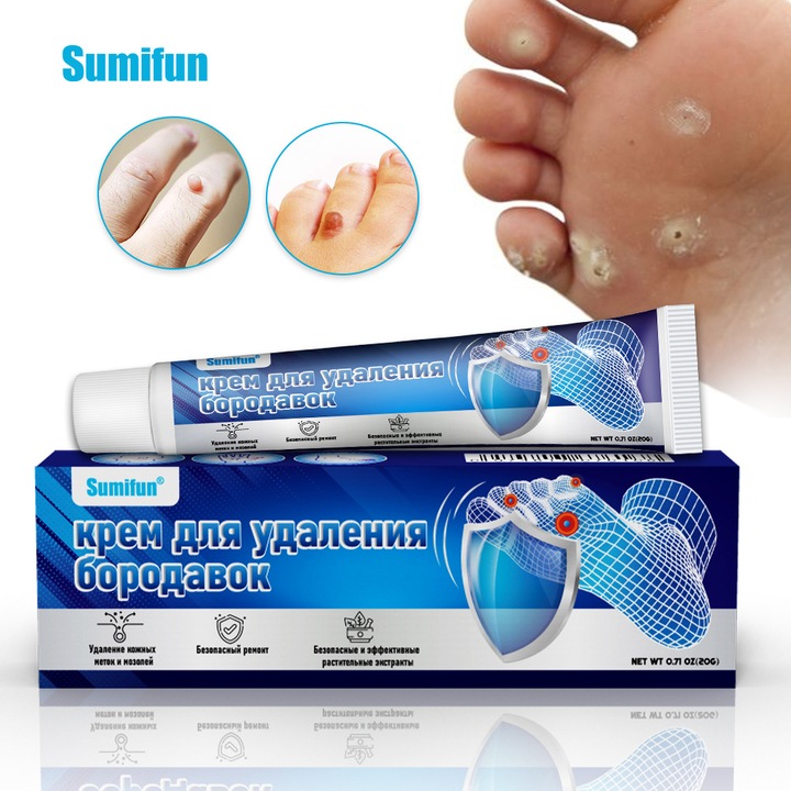 Crema pentru indepartarea negilor de la picioare, indeparteaza negii de la picioare, bataturi, negi, piele plata, crema antibacteriana pe baza de plante, indeparteaza bataturile