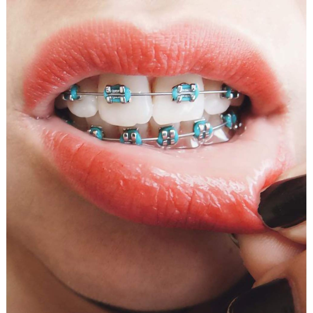 Legatura Fascette Legacavi Standard CIP - Foto 8