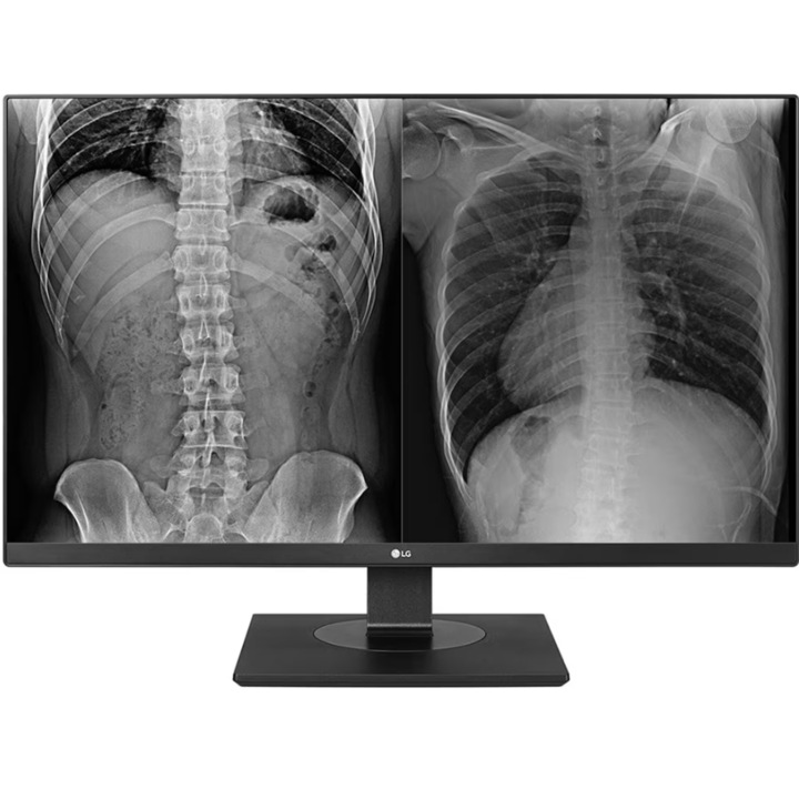 Professzionális orvosi monitor IPS LED LG 27" 27HJ713C-B, UHD 3840 x 2160, HDMI, DisplayPort, Pivot fekete